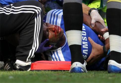 Drogba suffered a horrific injury